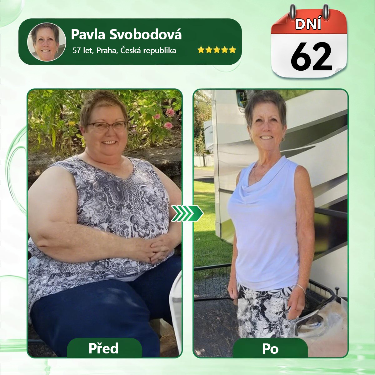 🔥 Odemčete si 50% vylepšení! Než se vrátíte do objednávky, přidejte si položku z 𝐃𝐑.𝐇𝐎𝐍𝐎𝐑® a co nejdříve posuňte svou rutinu na další úroveň. ⏳ Tato překvapivá nabídka zmizí v okamžiku, kdy opustíte tuto stránku.
