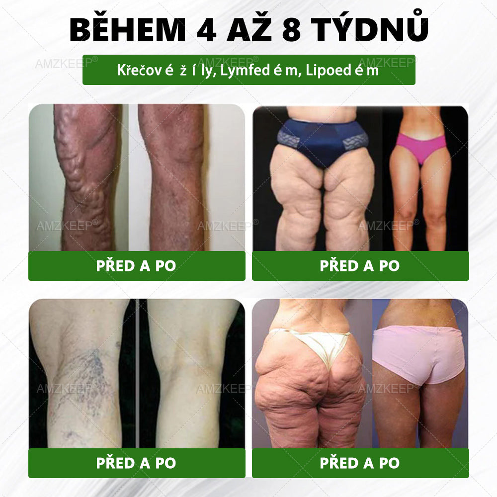 🔥 Odemčete si 50% vylepšení! Než se vrátíte do objednávky, přidejte si položku z 𝐀𝐌𝐙𝐊𝐄𝐄𝐏® a co nejdříve posuňte svou rutinu na další úroveň. ⏳ Tato překvapivá nabídka zmizí v okamžiku, kdy opustíte tuto stránku.