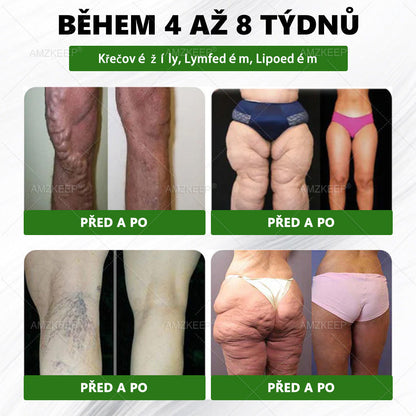 🔥 Odemčete si 50% vylepšení! Než se vrátíte do objednávky, přidejte si položku z 𝐀𝐌𝐙𝐊𝐄𝐄𝐏® a co nejdříve posuňte svou rutinu na další úroveň. ⏳ Tato překvapivá nabídka zmizí v okamžiku, kdy opustíte tuto stránku.